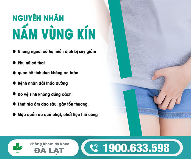 Hình ảnh minh họa